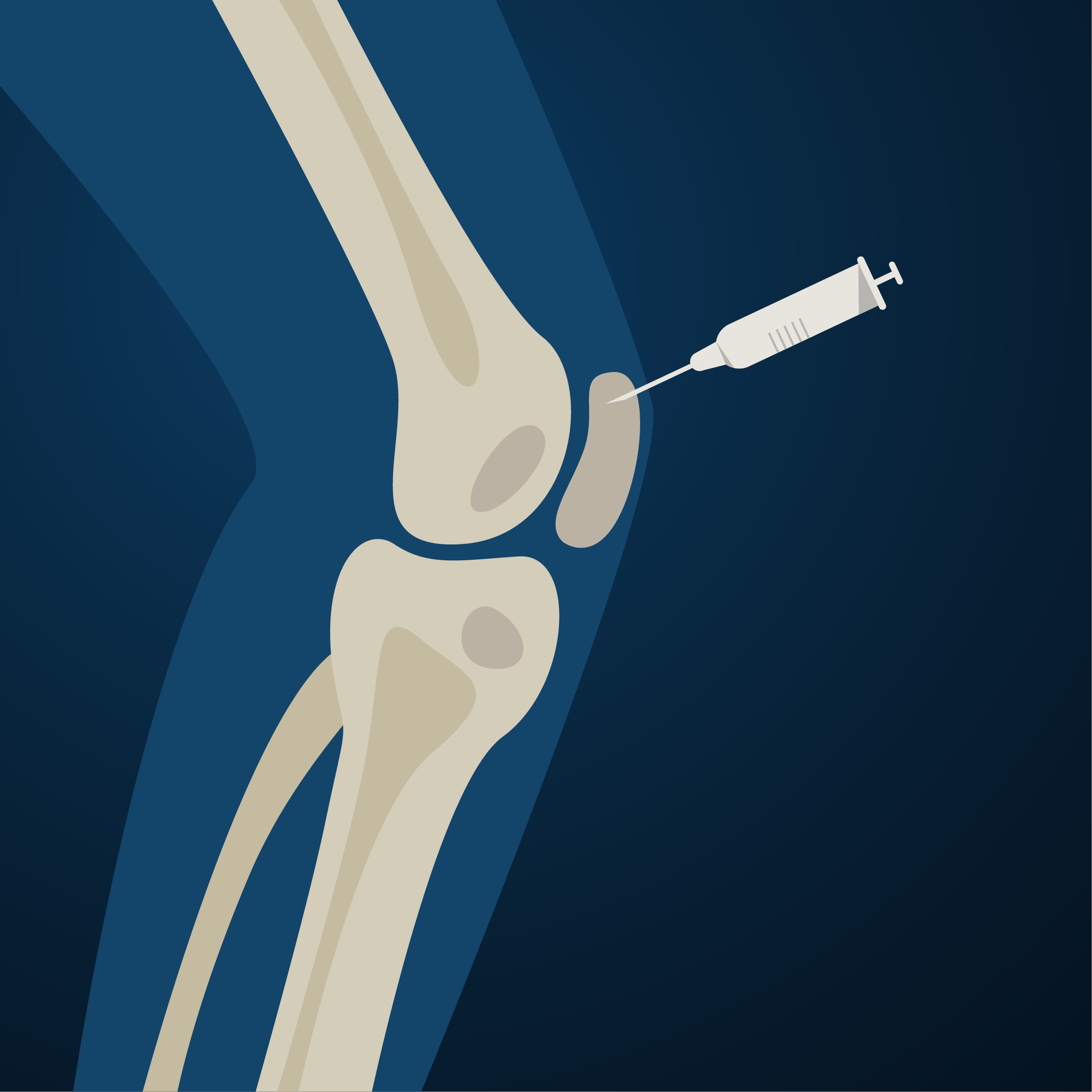 Although biologic treatments are still very new, early research is showing benefit for treating a variety of orthopedic conditions.