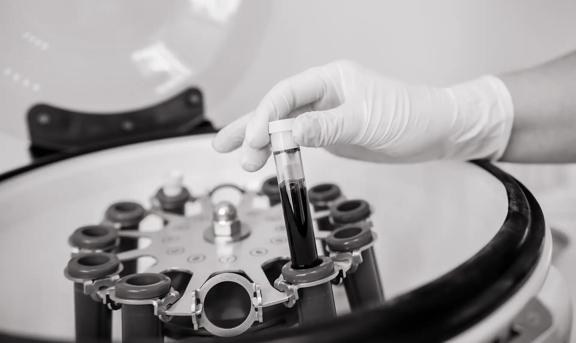 How long do PRP injections last?